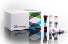 3-gene (E, N & RdRp) COVID-19 test includes: 1,050 µl reaction mixture, 550 µl of probe mixture, 50 µl of positive control and 50 µl of negative contr | 1018-00 displayed