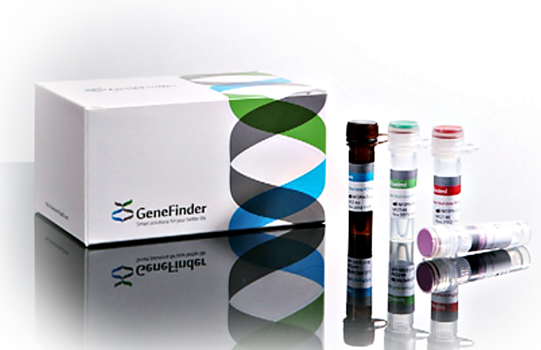 3-gene (E, N & RdRp) COVID-19 test includes: 1,050 µl reaction mixture, 550 µl of probe mixture, 50 µl of positive control and 50 µl of negative contr  |  1018-00 displayed