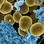 staphylococcus aureus bacteria viewed under an electron microscope