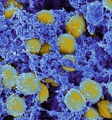 Staphylococcus aureus photo